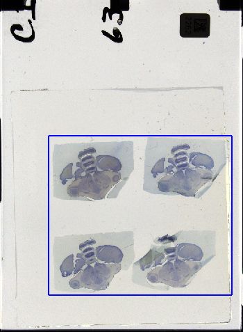 Media type: image; Special Collections 3298   shows specimen_part histological serial section;